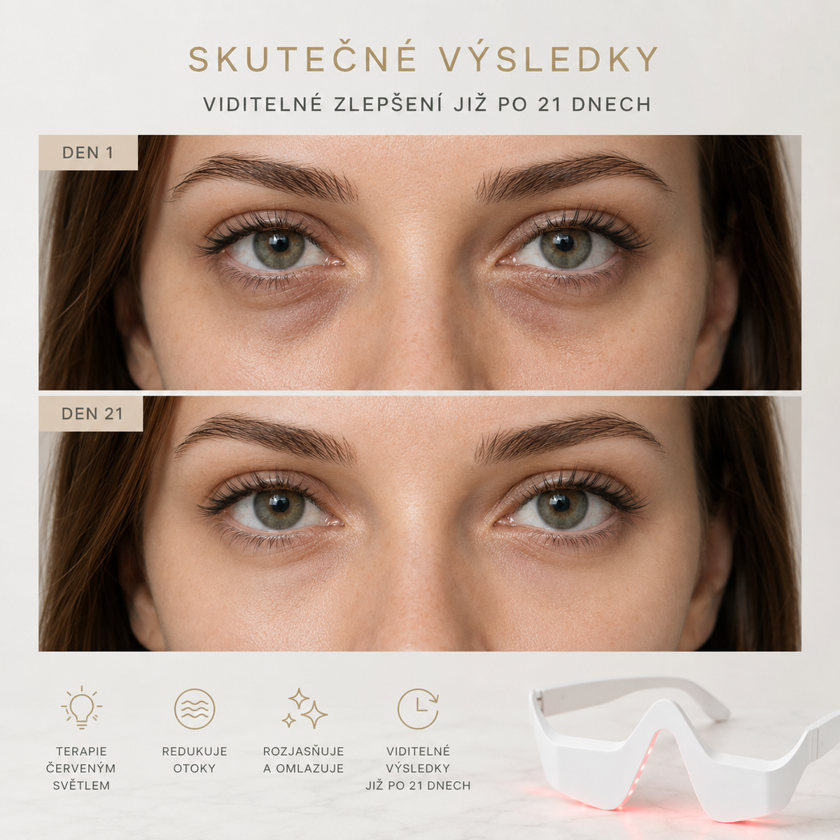 ELYVIA™: Terapie červeným světlem a mikroproudem
